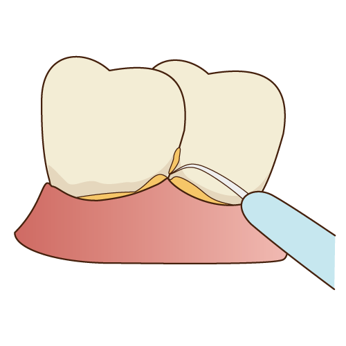 PMTC(1)