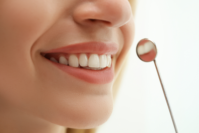 セラミック治療とは