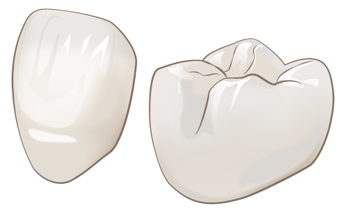 クラウン（被せ物）