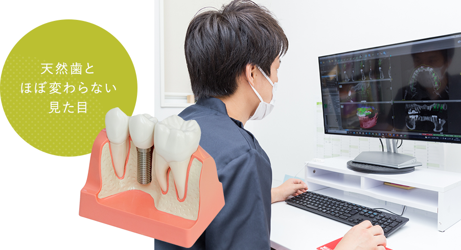 天然歯とほぼ変わらない見た目