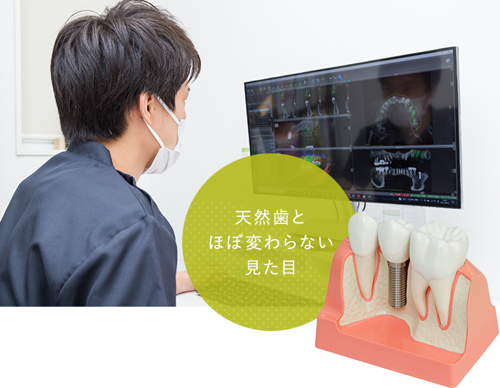 天然歯とほぼ変わらない見た目