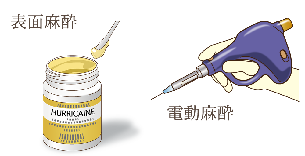 なるべく削らない・痛くない治療とは