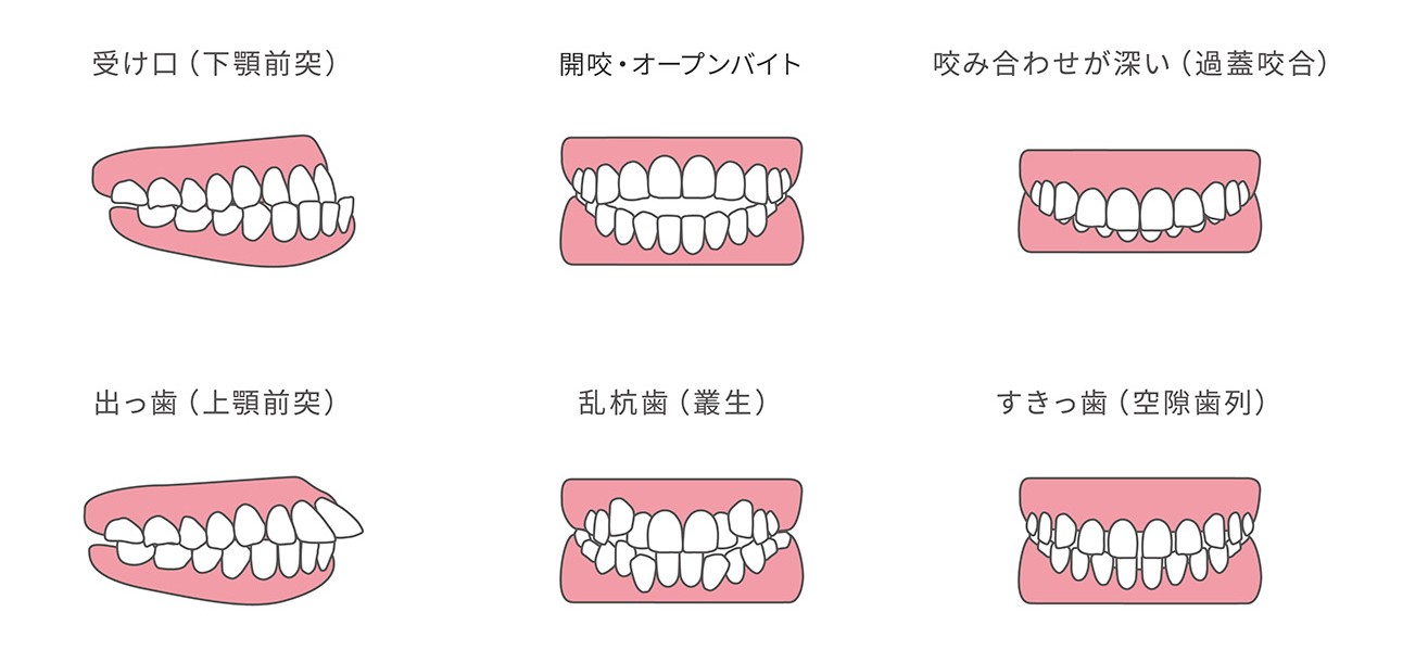 歯並びについて、こんなお悩みはありませんか？