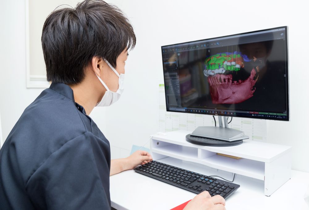 インプラントガイド