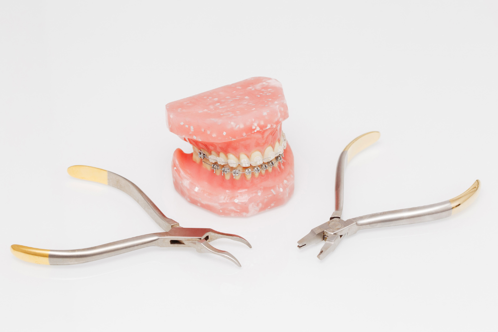 矯正専門医による矯正治療