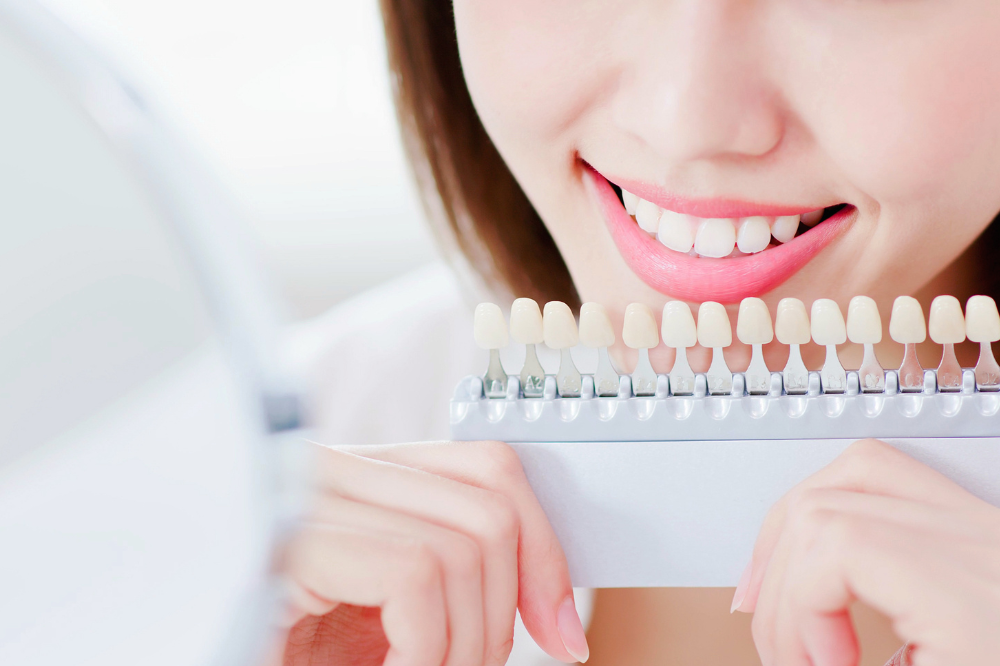 ホワイトニングって何？